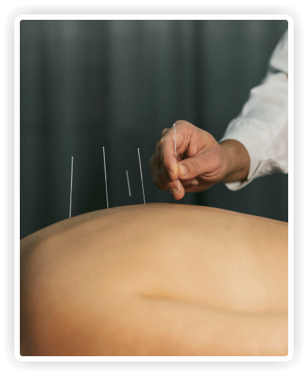 Fisio kedah - Physiotherapy near me - Urut - Bekam - Acupuncture - Sport massage - Jitra fisio - Knee pain - Strok - Sakit belakang