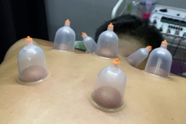 Fisio kedah - Physiotherapy near me - Urut - Bekam - Acupuncture - Sport massage - Jitra fisio - Knee pain - Strok - Sakit belakang